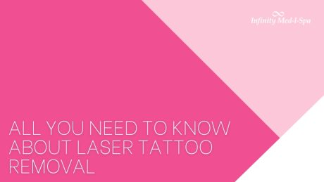All You Need to Know About Laser Tattoo Removal