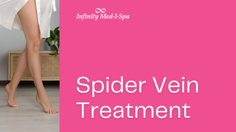 Spider Vein Treatment: Reclaiming Beautiful, Vein-Free Legs