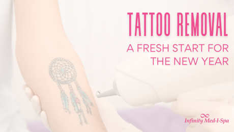Tattoo Removal: A Fresh Start for the New Year