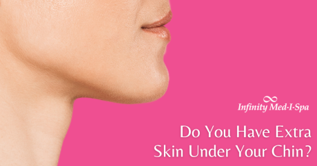 Do You Have Extra Skin Under Your Chin? 
